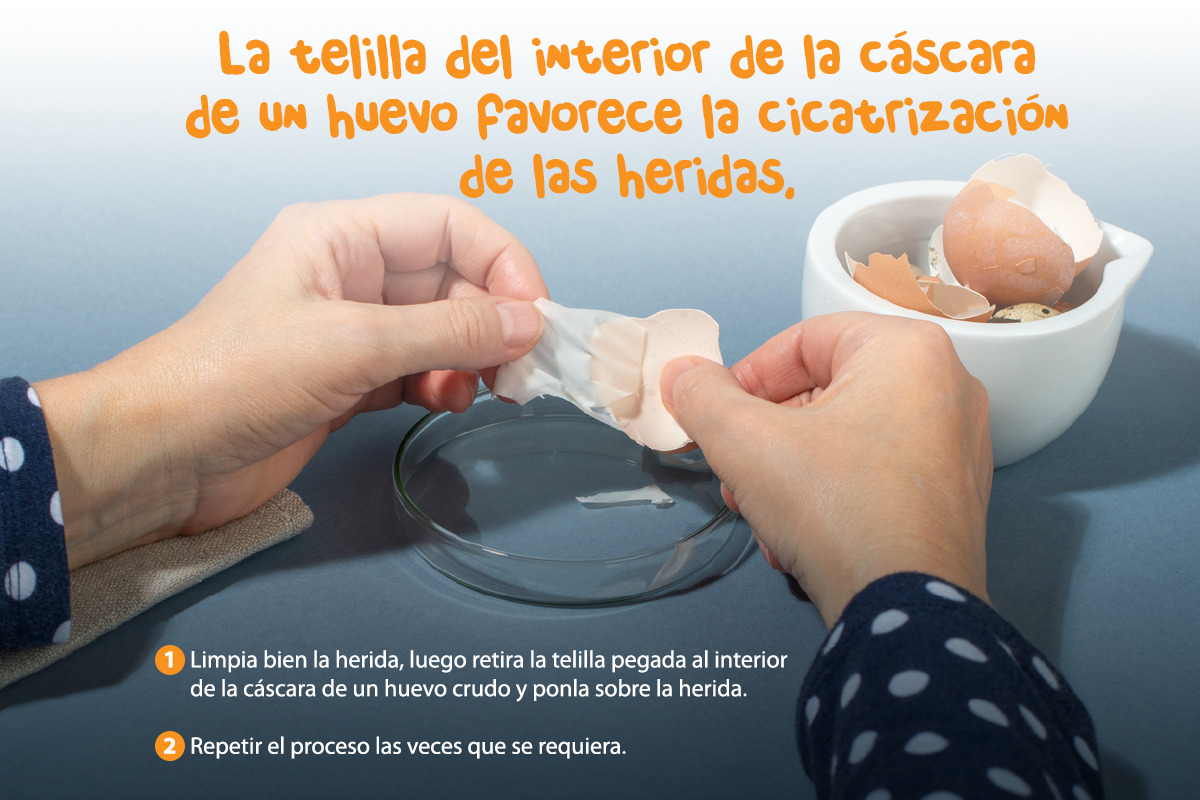 Tip de cicatrización